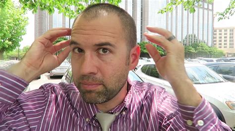 We've got all covered from hiding & fixing bad hairline to best hairstyles here. Growing Out Receding Hairline Buzz Cut: Sideburns Look Too ...