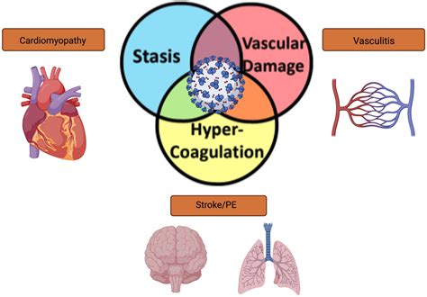 Frontiers Virchows Triad And The Role Of Thrombosis In Covid Related