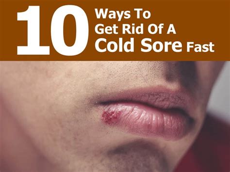 A herpes tzanck smear shows enlarged research findings suggest laser treatments may speed healing and lengthen the time before any. 10 Ways To Get Rid Of A Cold Sore Fast