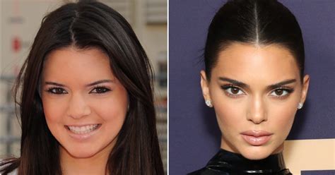 Kendall Jenners Transformation See Photos Of Her Then Vs Now