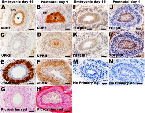 Histology And Immunohistochemistry Of Mouse Embryonic Ureters