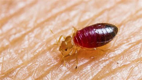 Bed Bugs Vs Scabies Which One Is Infesting Your Home