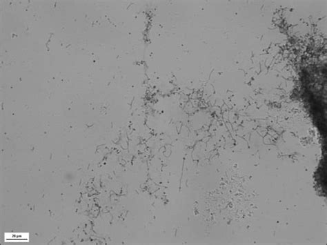 Gram Negative T Maritimum Cells In A Pleomorphic Shape Long