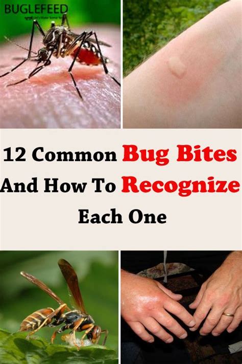 12 Common Bug Bites And How To Recognize Each One Bug Bites Itchy