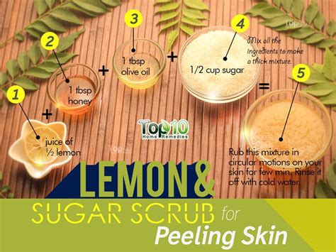 Home Remedies For Peeling Skin Top 10 Home Remedies