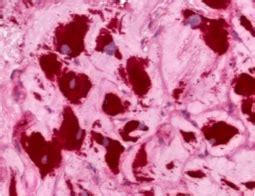 Výzkumné týmy ústavu histologie a embryologie. Kardiopathologie - Institut für Pathologie und Neuropathologie