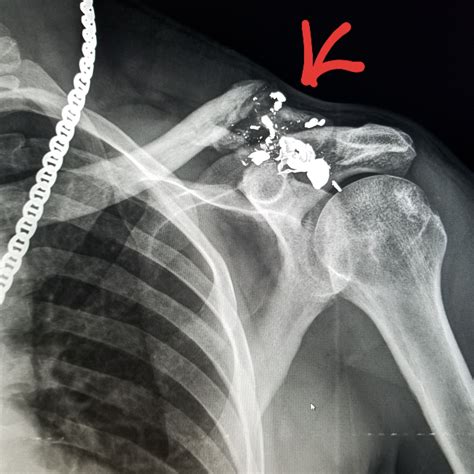 Pin On X Rays