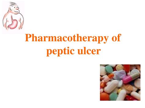 Ppt Therapy Ulcer Powerpoint Presentation Free Download Id3558888