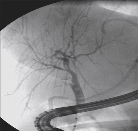 Image Of The Month—quiz Case Jama Surgery The Jama Network