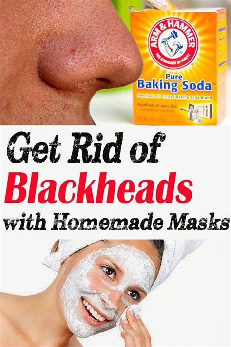 Get Rid Of Blackheads With Homemade Masks Crazy Beauty Tricks Get