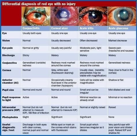 The 25 Best Red Eye Disease Ideas On Pinterest Red Dye Image Red