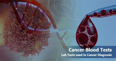 What Cancers Are Detected By Blood Tests Oncquest Blog Your Health Guide