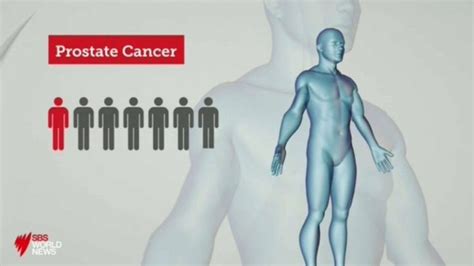 Scientists Find Faster And More Accurate Treatments For Advanced Prostate Cancer Sbs On Demand