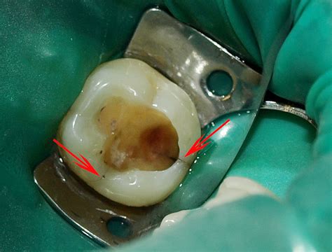 Simple Science: How to Make a Volcano with Kids