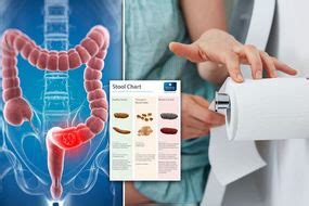 Bowel Cancer Symptoms Signs Of A Tumour Include Stomach Bloating Pain