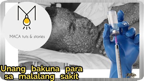 Ano Ang Pinaka Unang Bakuna Paano Ito Nadiskubre Sino Nakadiskubre Nito First Vaccine Youtube