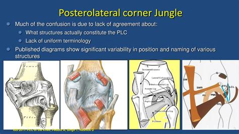 Ppt Posterolateral Corner Of The Knee Mri Anatomy Functional