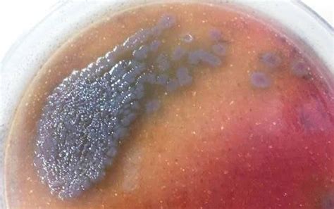 Colony Morphology Of Pseudomonas Aeruginosa In Macconkey Agar Showing