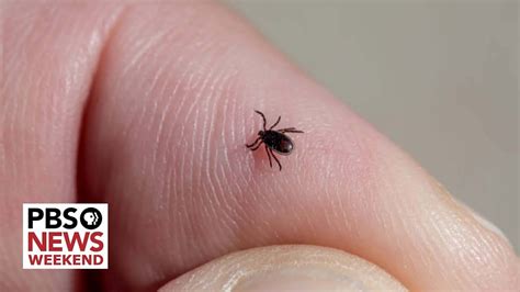 What You Need To Know To Stay Safe From Ticks And Lyme Disease This