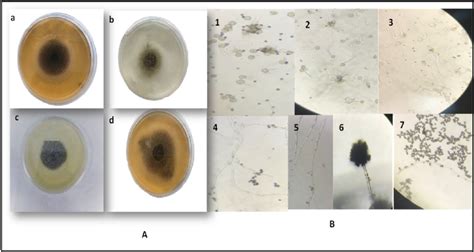 Morphological Characteristics Of Fungal Isolate Mr3 A Macroscopic