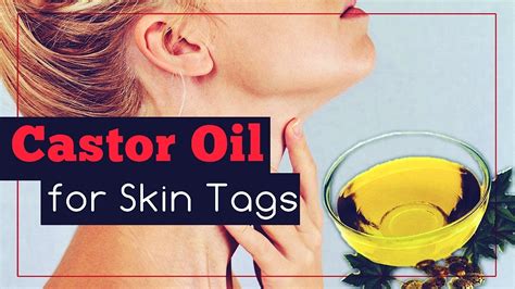 How To Use Castor Oil For Skin Tags Youtube