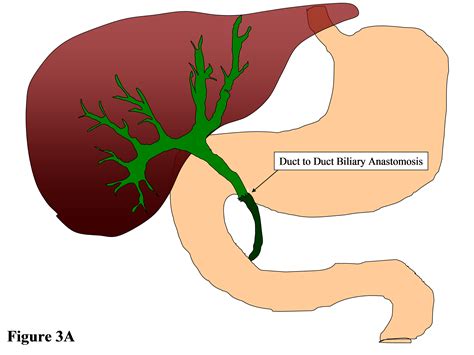 Liver And Common Bile Duct Anatomy