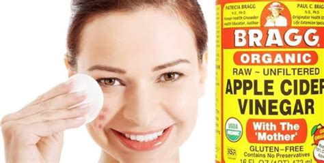How To Use Apple Cider Vinegar For Dark Spots On Face Ostomy Lifestyle
