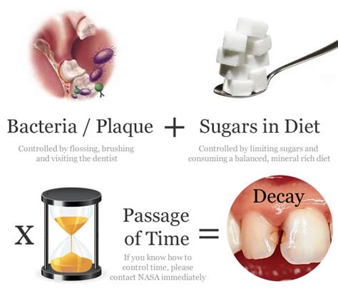 Why Prevent Tooth Decay Top Causes Of Decay