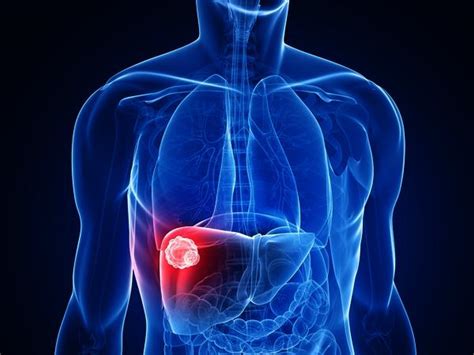 Sometimes, the pain refers to the front of the chest. Anatomy Under The Right Rib / Back Pain And Slipped Rib ...