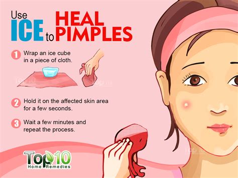 How to Get Rid of Pimples Fast | How to get rid of pimples ...