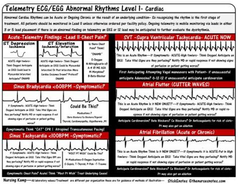 Ekg Cheat Sheet For Nurses Bing Ecg Rhythms Cardiac Nursing Cardiac