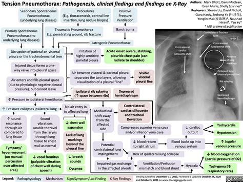 Tension Pneumothorax Pathogenesis Clinical Findings And Findings On