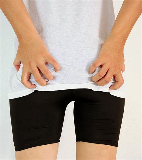 What is the recurrence rate after pilonidal treatment? 13 Pilonidal Cyst Home Treatments | Pilonidal cyst, Home ...