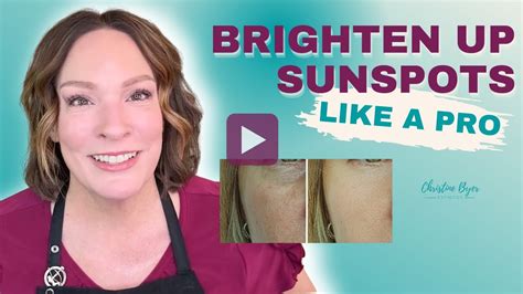 Reveal Flawless Skin Get Rid Of Sunspots Fast Youtube