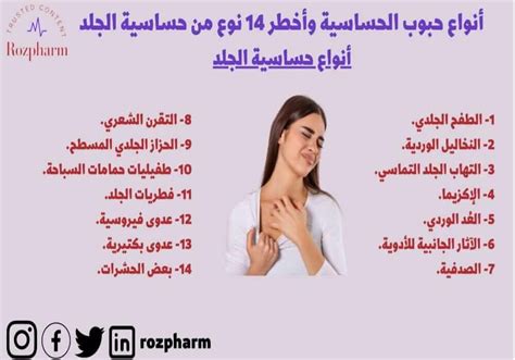 اسم دواء حساسية الجلد