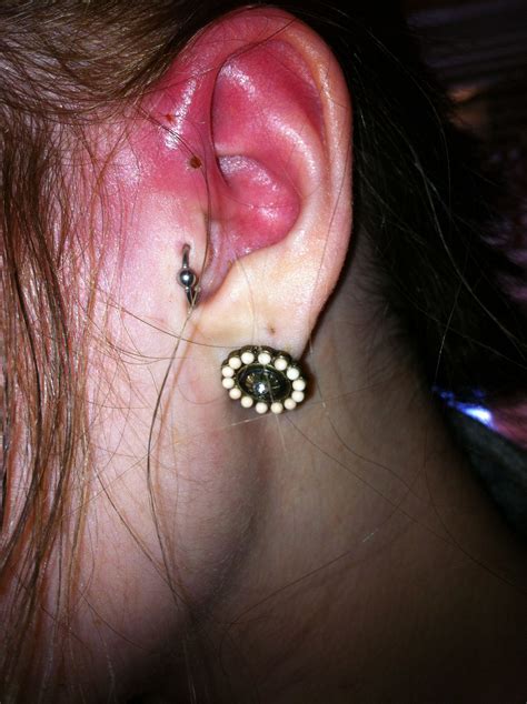 Infected Cartilage Piercing