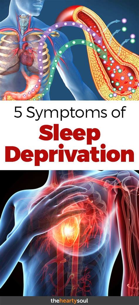 Sleep Deprivation Can Have Far Reaching Negative Consequences For Your