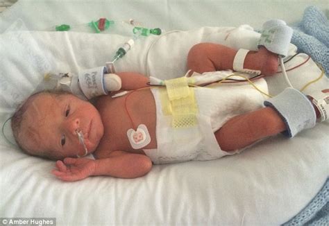 Mother Given An Emergency C Section After Giving Birth Naturally