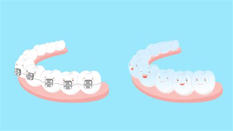 Invisalign Or Braces Does It Make A Difference Find Out More Here