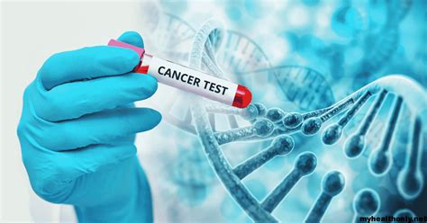 know the types of cancer testing you will be able to treat it soon