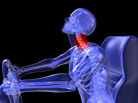 Spinal Whiplash Injuries