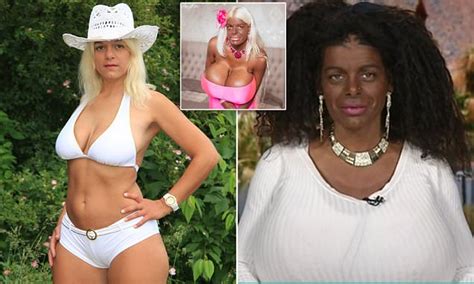 White Glamour Model Martina Big Wants An African Nose Daily Mail Online
