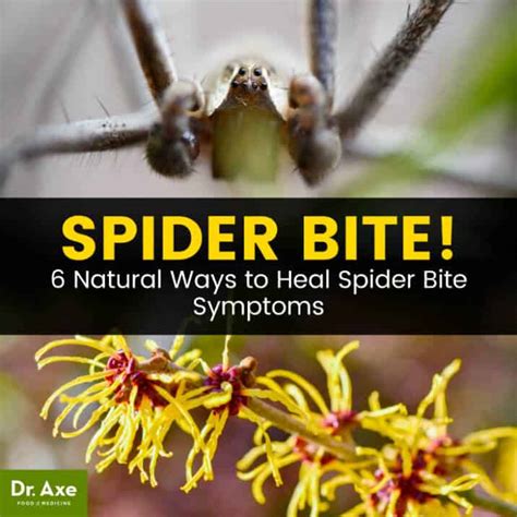 Spider Bite Symptoms How And When To Treat Them At Home Dr Axe