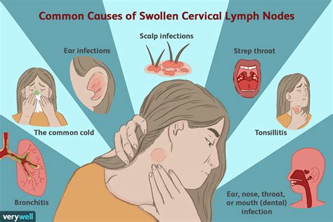 Preauricular Lymph Nodes Causes Of Swelling Porn Sex Picture