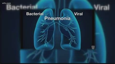 What Is The Connection Between Influenza And Pneumonia