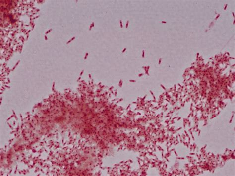 Gram Staining Microscopic Morphology In Gram Staining Of Blood Culture