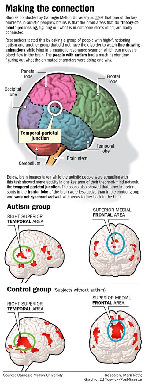 Autism And Brain Development