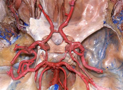 Circle Of Willis Labelled Arteries Anatomy Brain Anatomy Brain My Xxx