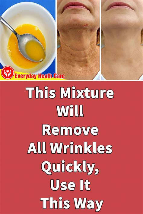 This Mixture Will Remove All Wrinkles Quickly Use It This Way In 2020 Wrinkles Remedies Face