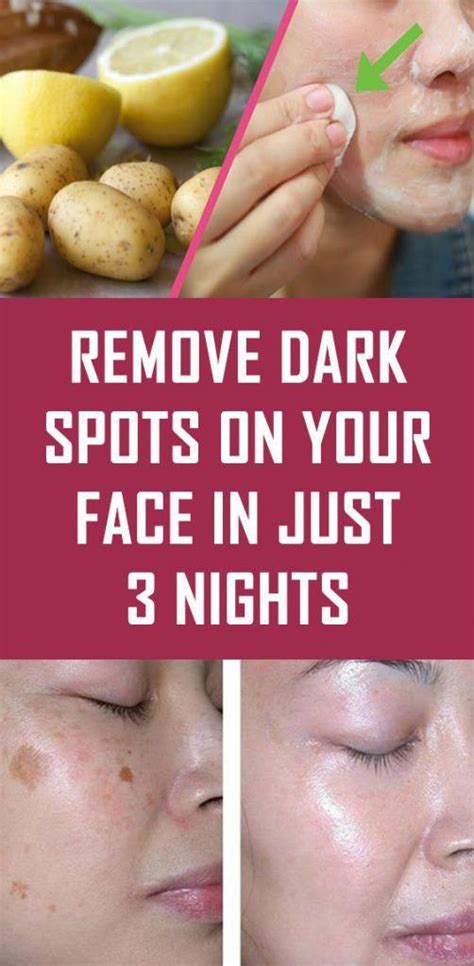 Remove Dark Spots On Your Face In Just 3 Nights Facemasks Remove